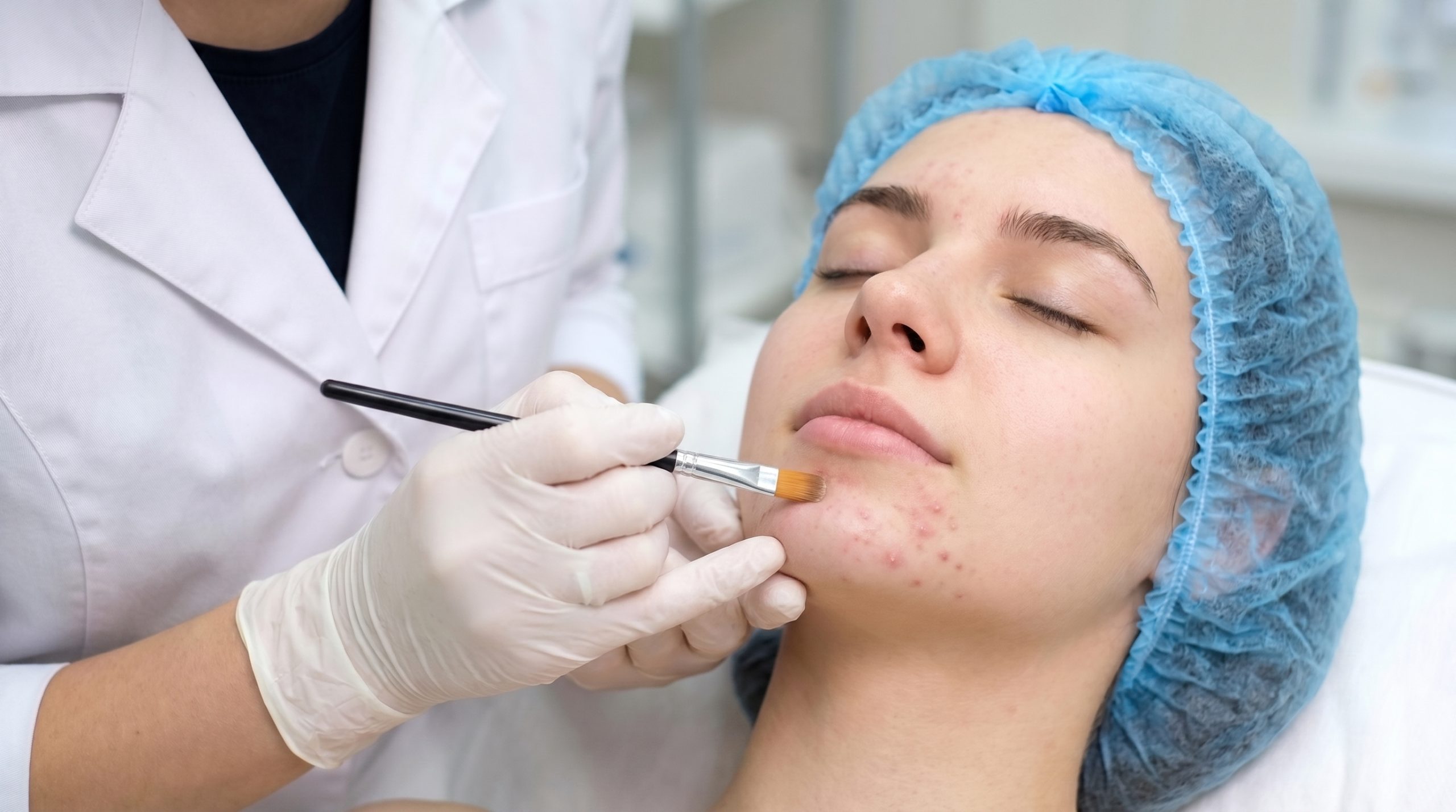 MEDICINA ESTÉTICA - PEELING QUÍMICO MÉDICO2