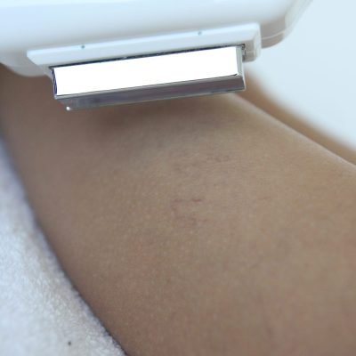 fototerapia-corpo